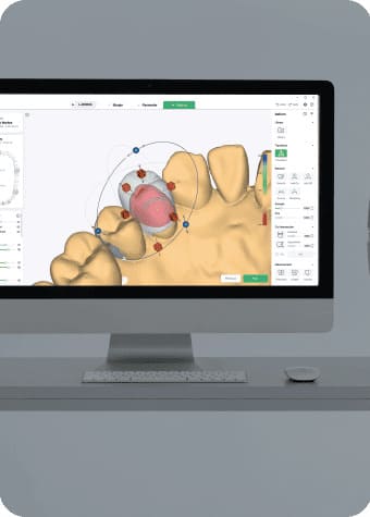 dental cad software 3d tooth design