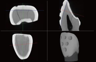 accuracy-of-measured enamel-layer-micro-ct-fit