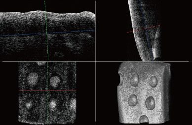 accuracy-of-measured enamel-layer-octix-fit