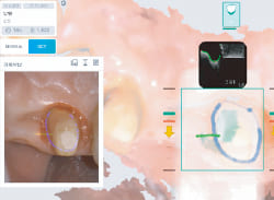 real-margin-point-contact-octix